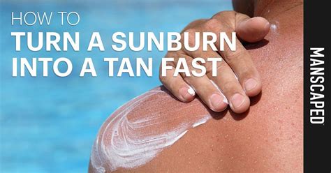 how to turn a sunburn into a tan